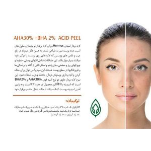 سرم دور چشم کافئین روشن کننده و جوانساز برند هرموس HERMOS